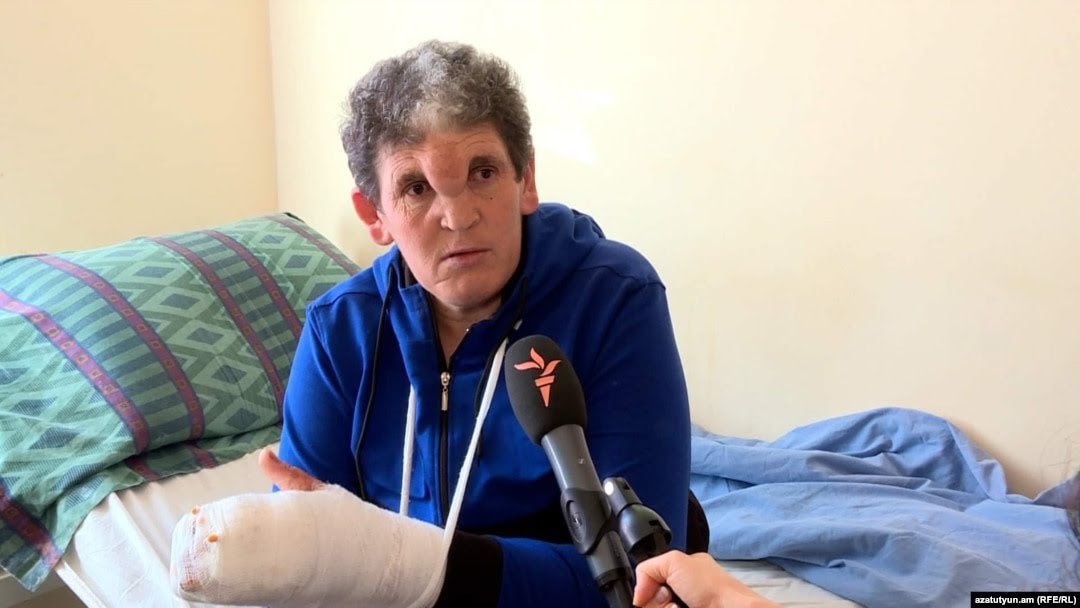 #MavrikPashayan, a 45-year-old man, endured a week of torment. Seated on his hospital bed, he recounted his harrowing escape from his hometown of #Sznek, his capture by the #Azerbaijan|i army, and the subsequent ordeal of torture, beatings, and humiliations.