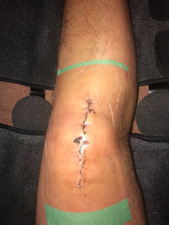 This is why <a href="/Qantas/">Qantas</a> sucks! I pick a right hand aisle seat so I can at least move my leg post surgery. They chose to move me last minute even though I’m gold status. I’m now a trip hazard to all and guess what. The cabin manager could not help at all! QF88 Seoul to Syd.