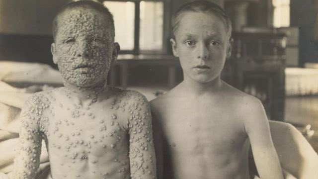 VirologyW's tweet photo. الإجابة الصحيحة هي الجدري.

فما هو الجدري؟
كيف ينتقل؟
ما هو معدل الوفاة للمصابين بهذا الفيروس؟
كيفية الوقاية منه

وماهي قصة جانيت باركر؟ آخر حالة أصيبت بالجدري في العالم

اجابات هذه الأسئلة تجدونها في المقال التالي:

https://t.co/f12tDs4oob https://t.co/IQghlCHwc4