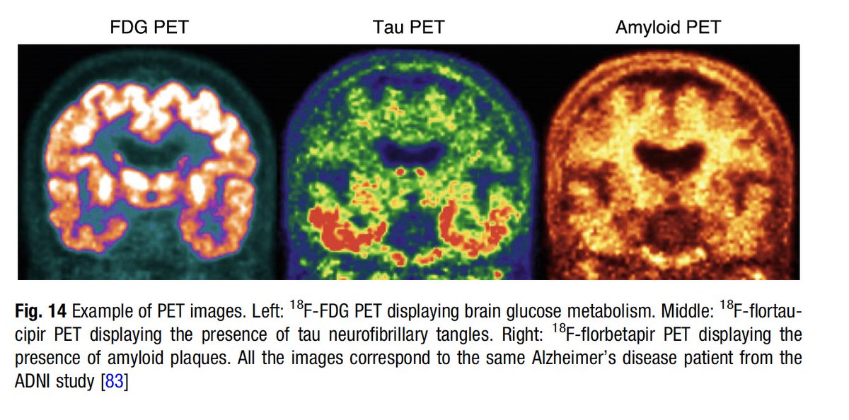 One chapter / day - Want to develop ML for neuroimaging? Learn about the nature of medical images, look at your data, understand it: medical images are not photographs :-) Check out this chapter by <a href="/NinonBurgos/">Ninon Burgos</a> link.springer.com/protocol/10.10…