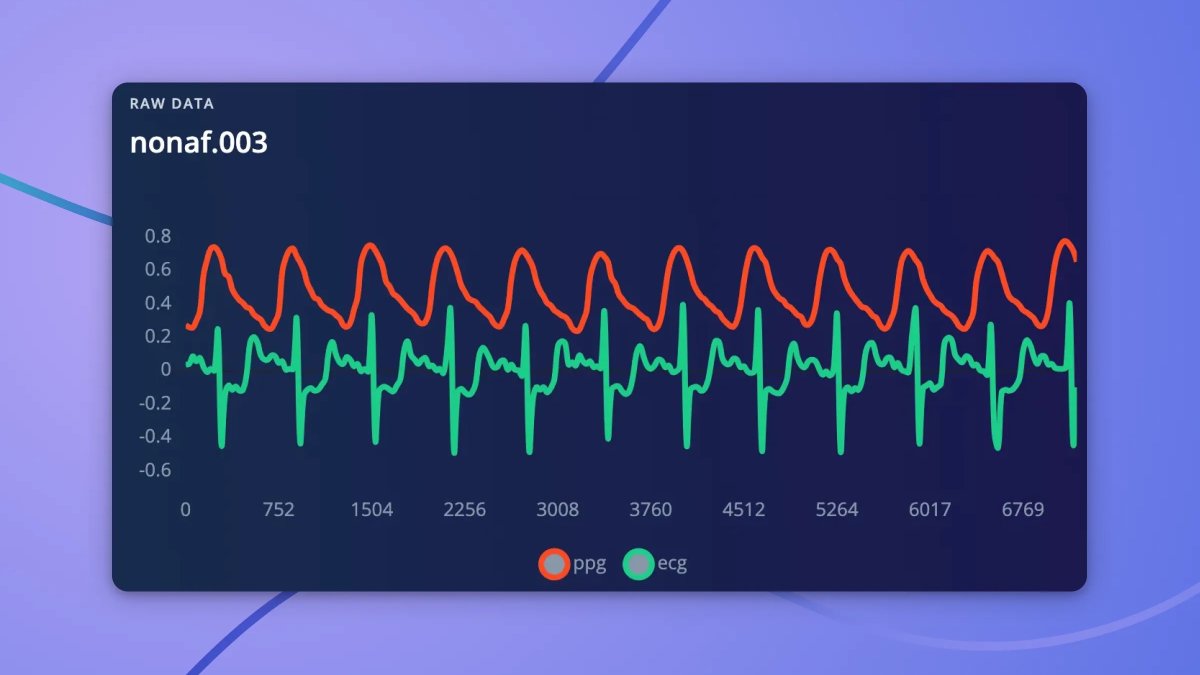 Edge Impulse tweet media