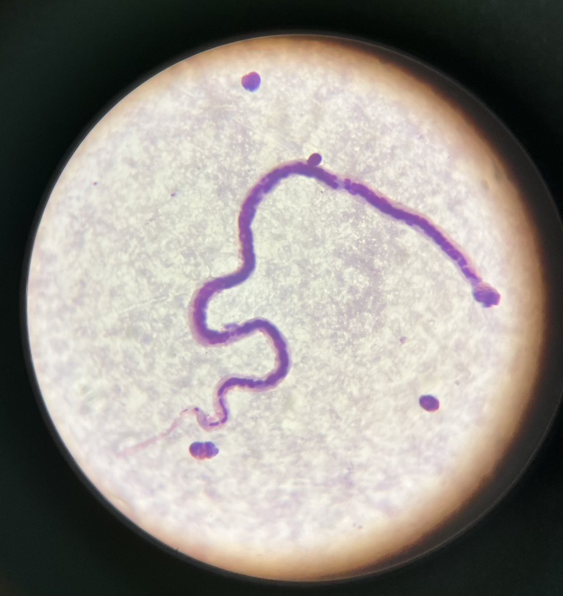 DagnallLab's tweet image. Some of our masters students are doing a spot of diagnostic parasitology today. What’s your diagnosis? 
#parasitology #lstm