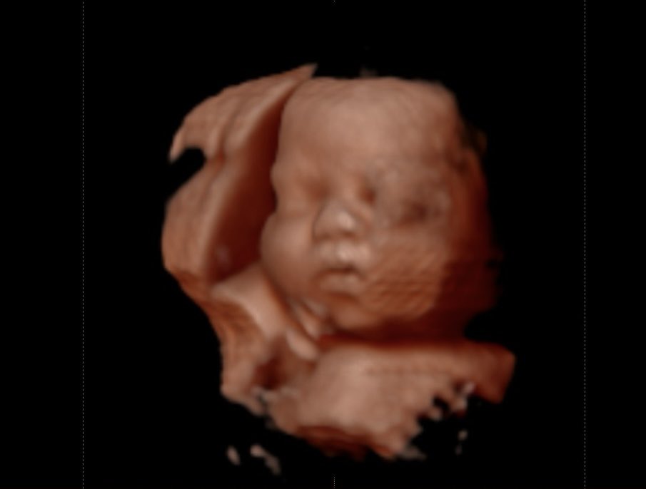 8 weeks left mi cachetona 🤎