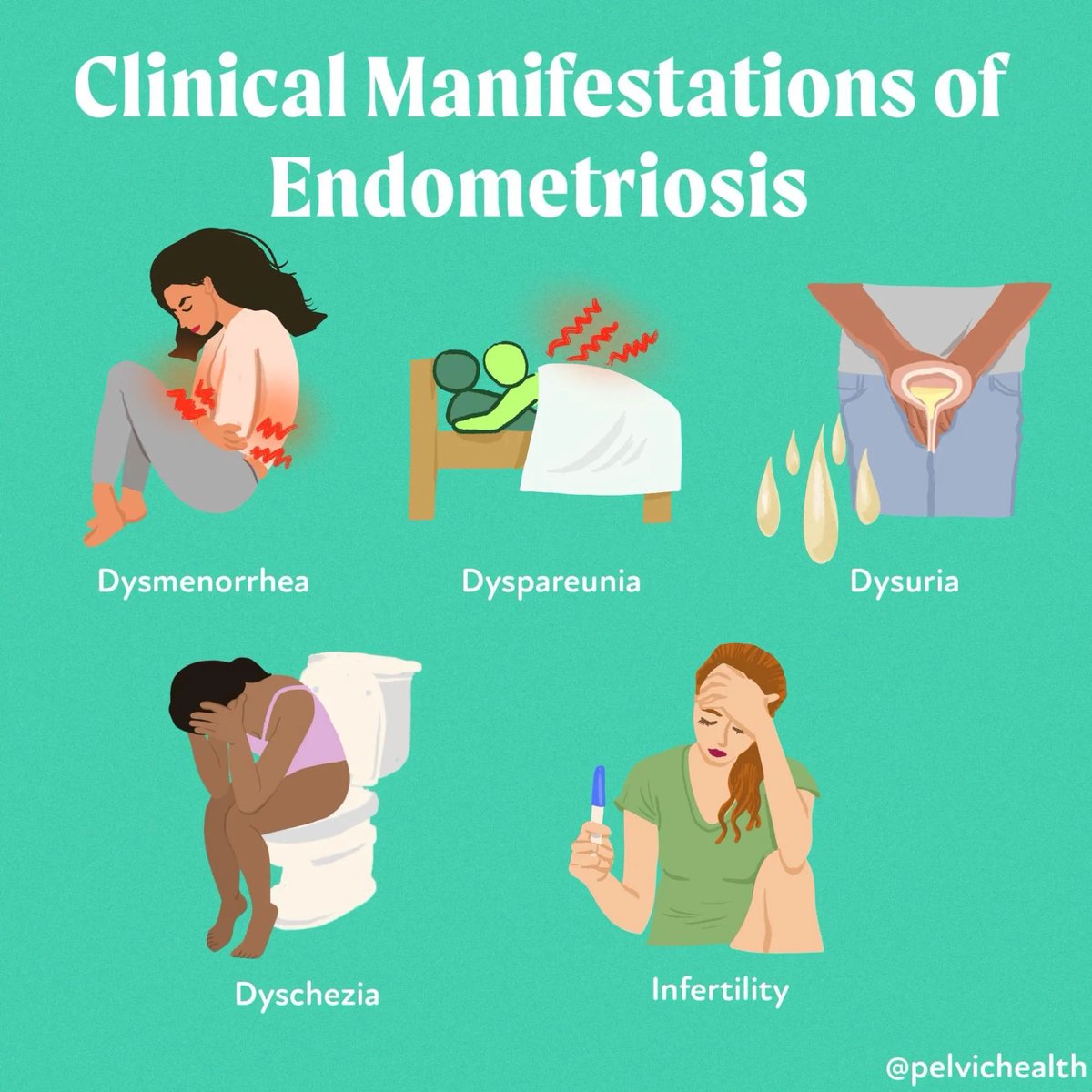 PelvicHealth's tweet photo. #Endometriosis is well known for its significant menstrual #pain, dysmenorrhea, and often silent #infertility 💛➡️ It has long been thought that this disease is a 'women's' disease or menstrual disease allowing for a long history of hysterectomies and hormone suppression. A 🧵 https://t.co/RYkKhtjOyU