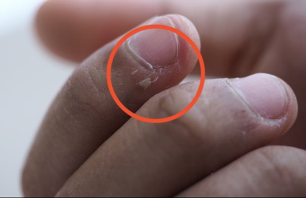 Le View Nails - HOW TO TREAT ROUGH, DRY AND HARD SKIN Many... | Facebook