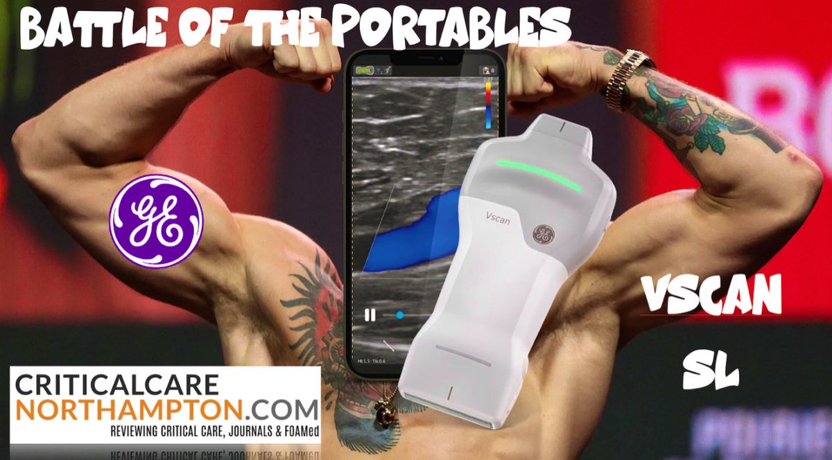 Jonny Wilkinson (@wilkinsonjonny) on Twitter photo Here’s the long awaited review of GE's new VScan SL!
Was it as good as its sister device, the <a href="/vscan/">GE HealthCare Vscan Family</a> Air? #POCUS #FOAMUS #FOAMed #FOAMcc <a href="/GEHealthCare/">GE HealthCare</a> <a href="/iceman_ex/">Segun Olusanya (He/Him) iceman_ex@critcare.social</a> <a href="/PARADicmSHIFT/">ʇɟıɥsI̍CͨMͫpɐɹɐd ≆ Dr Justin Kirk-Bayley</a> <a href="/khaycock2/">korbinhaycockmd</a> <a href="/ThinkingCC/">Philippe Rola</a> <a href="/load_dependent/">@load-depentent.bsky.social</a> <a href="/msiuba/">Matt Siuba</a> <a href="/TaotePOCUS/">𝗗𝗮𝗻𝗶𝗲𝗹</a> <a href="/WINFOCUS/">WINFOCUS WORLD</a>
criticalcarenorthampton.com/2023/10/09/bat… Here’s the long awaited review of GE's new VScan SL!
Was it as good as its sister device, the <a href="/vscan/">GE HealthCare Vscan Family</a> Air? #POCUS #FOAMUS #FOAMed #FOAMcc <a href="/GEHealthCare/">GE HealthCare</a> <a href="/iceman_ex/">Segun Olusanya (He/Him) iceman_ex@critcare.social</a> <a href="/PARADicmSHIFT/">ʇɟıɥsI̍CͨMͫpɐɹɐd ≆ Dr Justin Kirk-Bayley</a> <a href="/khaycock2/">korbinhaycockmd</a> <a href="/ThinkingCC/">Philippe Rola</a> <a href="/load_dependent/">@load-depentent.bsky.social</a> <a href="/msiuba/">Matt Siuba</a> <a href="/TaotePOCUS/">𝗗𝗮𝗻𝗶𝗲𝗹</a> <a href="/WINFOCUS/">WINFOCUS WORLD</a>
criticalcarenorthampton.com/2023/10/09/bat…