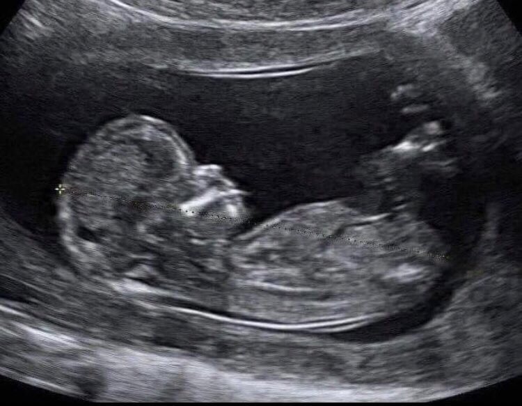 Başak burçlarının rahat ve stressiz uyuduğu son uyku