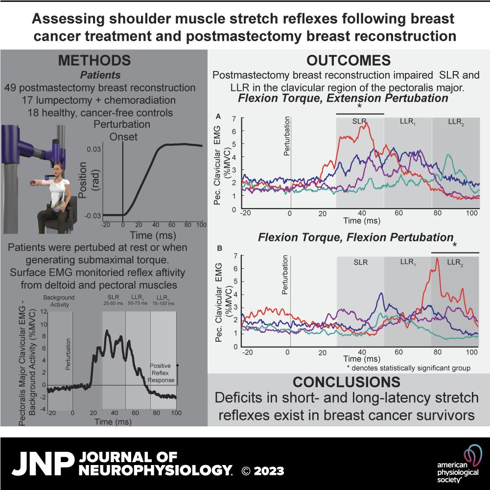 🔓#FreeArticleOfTheWeek @tealulic et al. examined short- and long-latency shoulder #muscle stretch reflexes in two experiments following common breast reconstruction procedures and #chemoradiation. 

🖱ow.ly/Gfmz50PNR1U

#BreastCancer #mastectomy #CentralNervousSystem