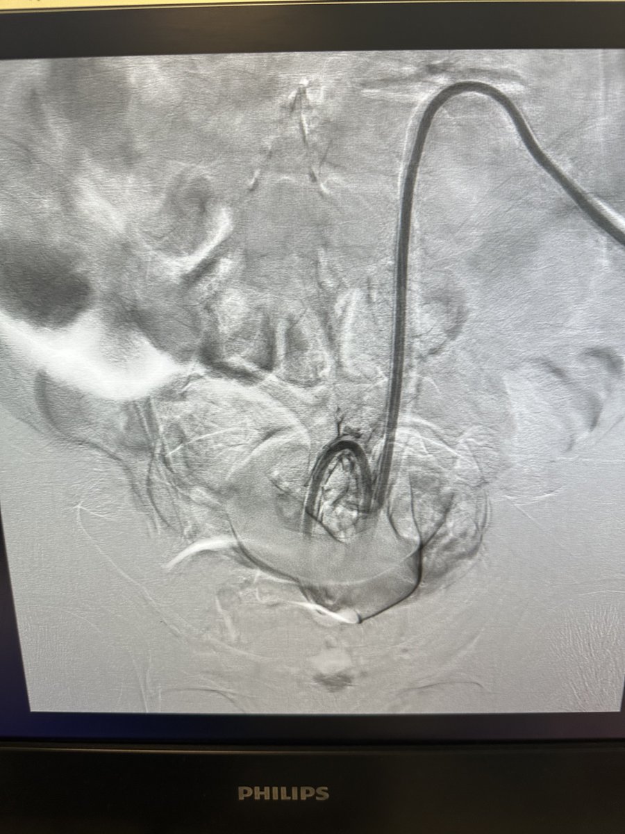 UNMC Kidney tweet media
