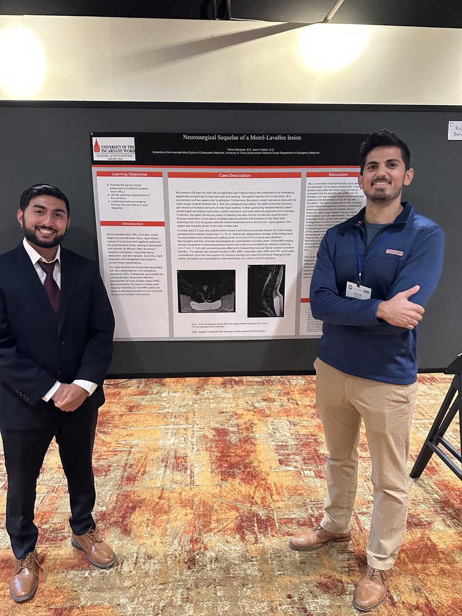 UTSW_EM's tweet photo. #ACEP23 poster presentation on Neurosurgical Sequelae of a Morel-Lavallee Lesion co-authored by @JasonVadhan @DallasEMed @UTSW_EM.
#ACEPNow #emergencymedicine #emresearch https://t.co/qvISEouJ1E
