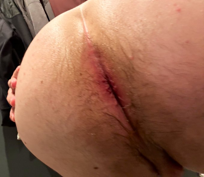 I just got my ass bred by a much older man and he was very rough. I&rsquo;m still dealing with anal pain, but<a href="/tag/anal"class="tags"><span>#anal</span></a><a href="/tag/gape"class="tags"><span>#gape</span></a><a href="/tag/breeding"class="tags"><span>#breeding</span></a>