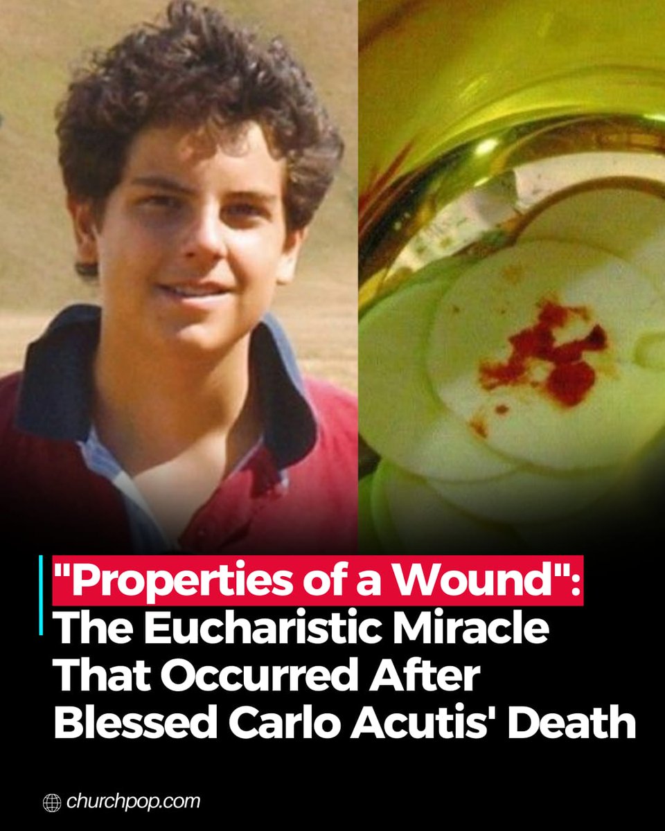 Church_POP's tweet photo. "Properties of a Wound": The Eucharistic Miracle That Occurred After Blessed Carlo Acutis' Death

On Oct. 12, the Catholic Church celebrates the feast of Blessed Carlo Acutis, the young saint devoted to spreading his love for Eucharistic miracles.

Father Mark Goring of Saint Mary’s Parish in Ottawa, Ca. explained an amazing Eucharistic miracle that occurred a few days following Blessed Carlos Acutis’ death.

Blessed Carlo is best known for his computer programming skills and his website dedicated to Eucharistic miracles. He died of leukemia on Oct. 12, 2006, at age 15. Pope Francis beatified him on Oct. 10, 2020.

Father Goring explains the “phenomenal” Eucharistic miracle that occurred on Oct. 21, 2006, in Tixtla, Mexico. 

He said many people associate it with Blessed Carlo because of his deep devotion to the Eucharist and how closely it occurred following his death.

“A religious sister was giving out communion at communion time…” Father Goring says as he quotes the book, “Eucharistic Miracles of the World.”

“Her eyes filled with tears. This immediately attracted the celebrant’s attention. The host she had taken to give communion to a parishioner had begun to ooze a reddish substance.”

Father Goring then explains what scientific researchers found:

“Two studies conducted by eminent forensic experts with different methods have shown that the substance originates from the interior, excluding the hypothesis that someone could have applied it from the outside.”

“This was a fascinating discovery–this red substance that oozed from the consecrated host had the properties of a wound,” Father Goring comments.

“The blood comes from inside the body and spreads out.”

“[The book] goes on to say, ‘the tissue corresponds to heart muscle.’ (Which is so consistent in all the Eucharistic miracles–we find human heart tissue.

“It says, ‘No study exists that can maintain cardiac tissue alive in this situation. Normally after 48 hours, the tissue dies. While here, three months had passed before the result could be obtained, and this is truly inexplicable for science.”

Most Rev. Alejo Zavala Castro (the bishop of the Diocese of Chilpancingo-Chilapa at the time), requested this scientific investigation through Dr. Ricardo Castañón Gómez.

The scientific team released this statement:

“The reddish substance analyzed corresponds to blood in which there is hemoglobin and DNA of human origin. 

"Two studies by eminent forensic experts using different methodologies have shown that the substance originates from within, excluding the hypothesis that someone could have placed it from the outside.

“The blood type is AB, similar to that found in the Lanciano Host and the Shroud of Turin. A microscopic magnification and penetration analysis reveals that the upper part of the blood has coagulated since October 2006. In addition, the underlying inner layers revealed, in February 2010, the presence of fresh blood.

“The event has no natural explanation.”

https://t.co/gAaKZX7O2I
