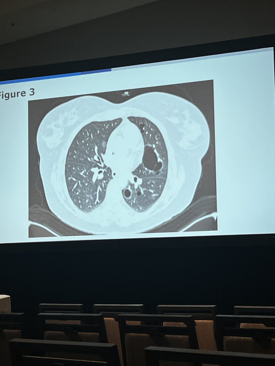 Which imaging is the most fascinating and why is it #lung imaging?

#CHEST2023 #PCCM #CHESTTrainees