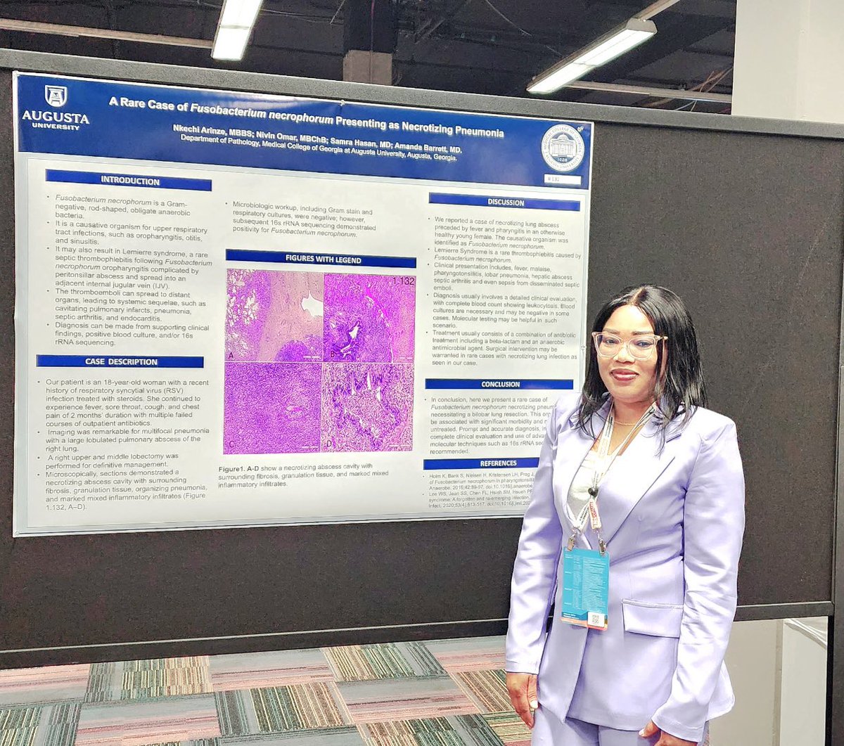 MCG_Pathology's tweet photo. October, the time for conferences! This year Dr. Arinze presented a case report at CAP and Dr. Ramsey gave an oral presentation at ASDP, with support from our program director, Dr. Powell!

#pathology #cap23 #asdp23 #pathmatch24 https://t.co/O8lPNz8Jef