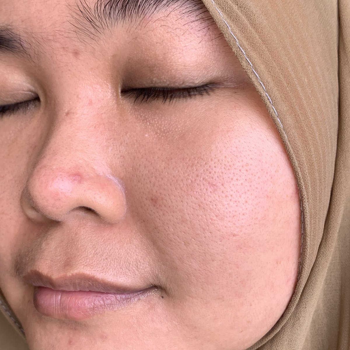 destinawah's tweet photo. Emang boleh punya toner sejuta umat ini? Pantes si banyak yang suka, soalnya di kulit aku beneran ngefek banget.
Beneran jadi racun 10:10 ni, jangan sampe ga checkout loh๐ฉ.
#SaveTheSkin #MightyBooster #racuninskincare #keracundesti https://t.co/jNTvXoyPwH