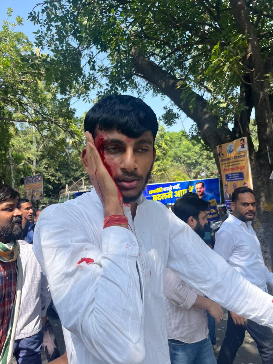 AAPUttarPradesh's tweet photo. एक-एक लहू की बूंद से इन्कलाब लिखेंगे
ऐ तानाशाह! तेरे हर जुल्म का हिसाब लिखेंगे

#संजय_सिंह_शेर_है https://t.co/qccJepCwhC