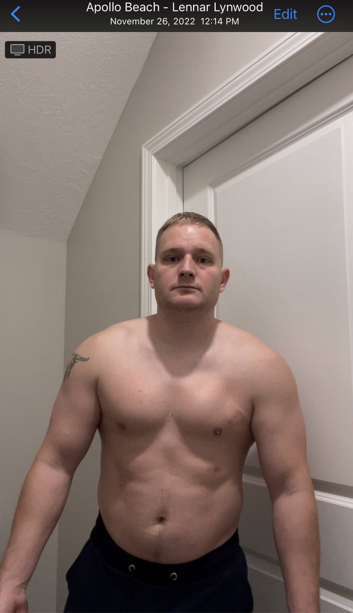 rayshhhhhh's tweet image. Photo before (Nov 2022) and now. 

Guys, if you have low #testosterone and 
1. Not getting results in the #gym you desire
2. Are continuously #demotivated
3. Have #brainfog
4. Low sex drive
5. Have a bubble gut you can’t get rid of

Check out @tclinics_usa…