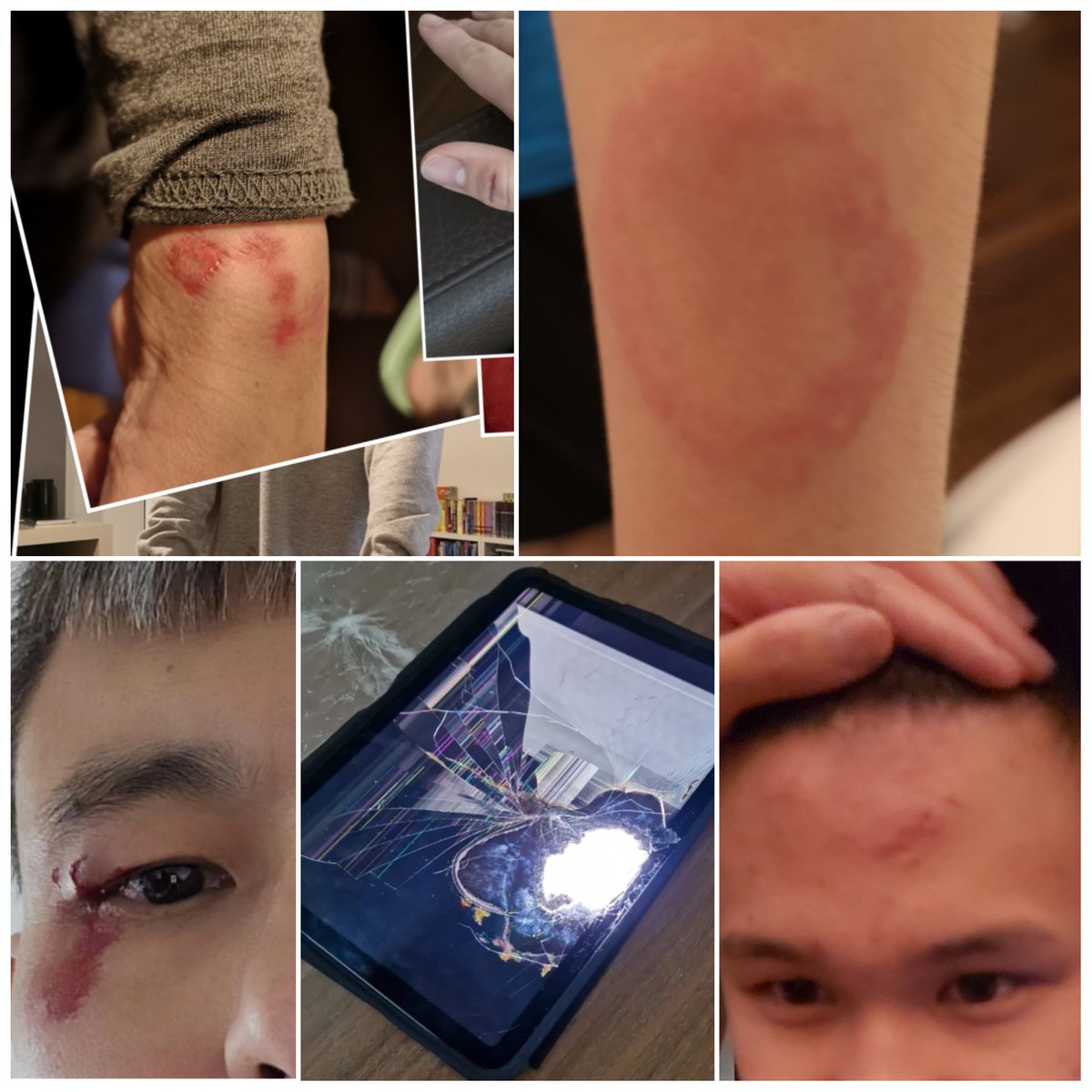 10th Oct is #WorldMentalHealthDay 8 of 10 #autistic people experience #mentalhealth issues
B has anxieties, OCD, explosive behaviours, self-harming, shouting, hitting, smashing items.😔
As an #autismfamily we will support him always❤️ #picturepaintsathousandwords #BeKindAlways