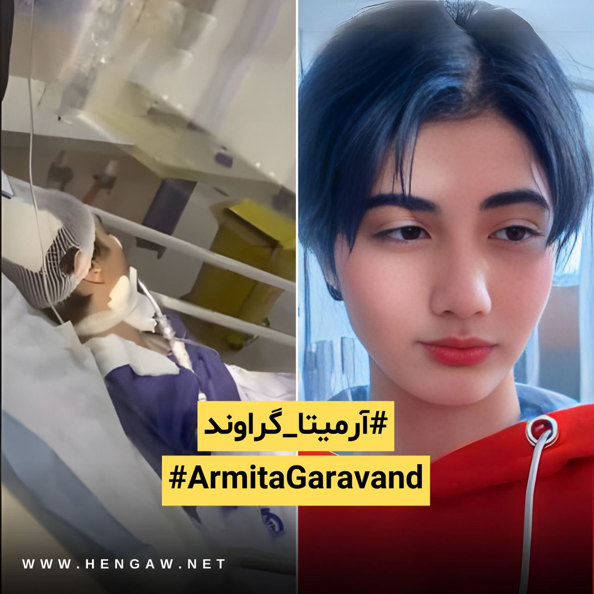 azkurdm_'s tweet photo. هه‌نگاو نسبت به وضعیت سلامت آرمیتا گراوند بشدت ابراز نگرانی میکند. نیروهای امنیتی خانواده ، دوستان و حتی تیم پزشکی وی را تحت شدیدترین کنترل‌های امنیتی قرارداده و هیچ گونه اطلاعی در خصوص وضعیت وی در دسترس نیست. 
#ژینا_امینی
#آرمیتا_گراوند https://t.co/FesoyXGMOs