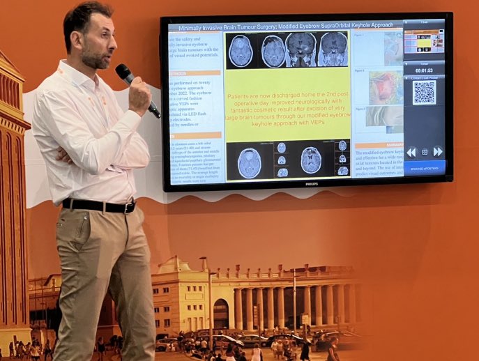 Anastasios Giamouriadis (@anastasios_giam) on Twitter photo Thank you <a href="/The_SBNS/">SBNS</a> & <a href="/EANSonline50/">European Association of Neurosurgical Societies</a> for endorsing our pioneering @minimallyinvasivebraintumoursurgery <a href="/NHSGrampian/">NHS Grampian</a> Our patients are now home 2nd day after removal of even large brain tumors through our keyhole approach Thank you <a href="/The_SBNS/">SBNS</a> & <a href="/EANSonline50/">European Association of Neurosurgical Societies</a> for endorsing our pioneering @minimallyinvasivebraintumoursurgery <a href="/NHSGrampian/">NHS Grampian</a> Our patients are now home 2nd day after removal of even large brain tumors through our keyhole approach