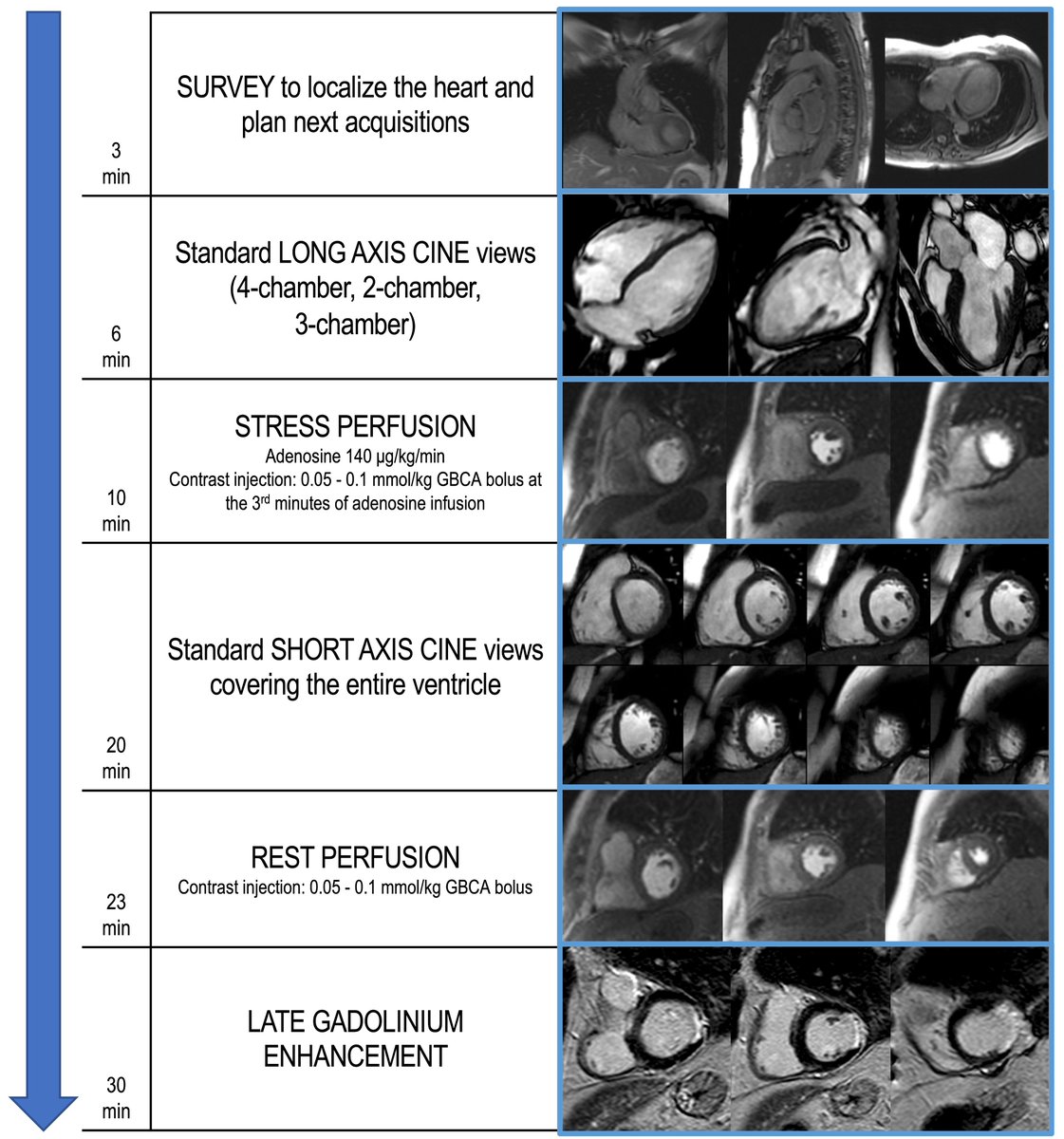 RCMjournal's tweet photo. #RCM-Vol. 24 No. 9
🎨Review
Stress Cardiovascular Magnetic Resonance Imaging for the Detection of Coronary Artery Disease
🖍️from Giulia Vinco, @clementinadugo, @MarziaRigolli, @CriDematte, @jjtwetta et al.

#CMR #CAD #imaging #myocardial

🔔Full Text:
https://t.co/giDbgV8hwY https://t.co/XJIS9V2r2t