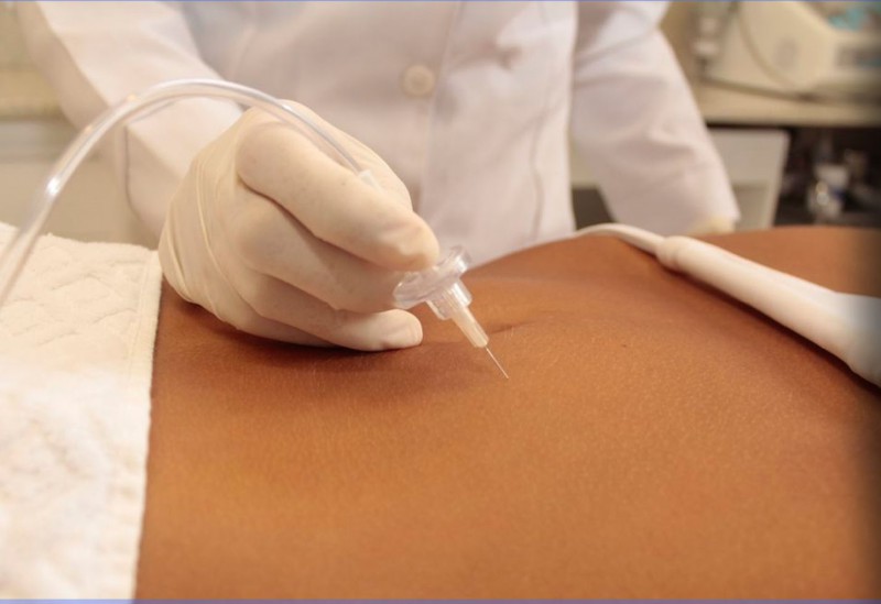 SkinOnlineBlog's tweet photo. Imagine a treatment that combats scarring, lessens those pesky stretch marks, and says 'au revoir' to fat &amp; cellulite https://t.co/7EmbhGh7ax

#SkinOnline #SkinOnlineBlog #SkinTighteningMagic #stretchmarks #tightmuscles #NewYouCarboxyGlow #CarboxyCraze #GlowGetterGoals https://t.co/NNeWyQLJaV