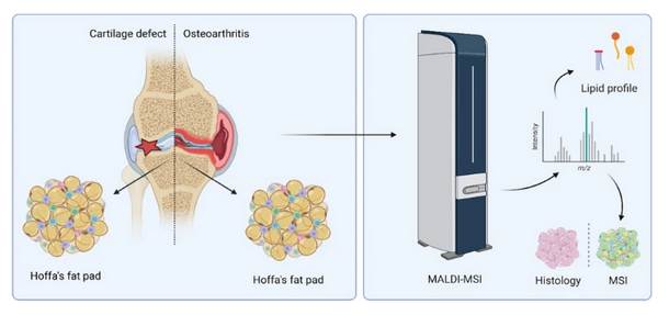 MALDI-MSI reveals potential #lipid #markers between infrapatellar fat pad biopsies of #osteoarthritis and #cartilage defect patients
by Berta Cillero-Pastor et al @MaastrichtU @Cillero_Lab @CAPHRI_UM @MaastrichtUMC @AMSmovement 

#OpenAccess 
link.springer.com/article/10.100…