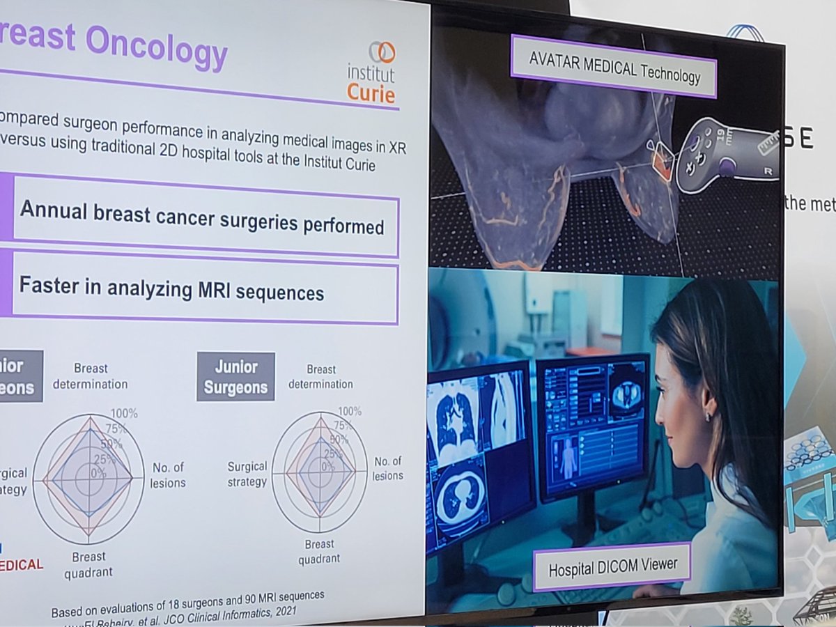Superbe cas d'usage de la #VR par @Avatar_Medical afin d'améliorer l'efficacité des analyses oncologiques. L'idée: reconstruire les IRM en 3D pour permettre une exploration précise et ergonomique Bravo à l'équipe et l'@Institut_Curie #OctobreRose #XR #surgery #CancerAwareness