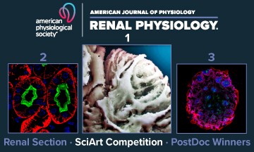 AJP Renal (@ajprenal) on Twitter photo 📢The VOTING has started!!!!
“Clash of the Kidneys: Return of the Electrolytes”
Choose your favorite SciArt- Vote here!
🖱️ow.ly/2PgR50PVc0x
Deadline: November 1, 2023
#AJPRenal <a href="/APSPublications/">APS Publications</a> <a href="/APSPhysiology/">American Physiological Society</a> <a href="/AJPRenalEIC/">Dr. Heddwen Brooks, PhD, AJP-Renal Editor-in-Chief</a>
<a href="/c_a_klemens/">Chris Klemens</a> 📢The VOTING has started!!!!
“Clash of the Kidneys: Return of the Electrolytes”
Choose your favorite SciArt- Vote here!
🖱️ow.ly/2PgR50PVc0x
Deadline: November 1, 2023
#AJPRenal <a href="/APSPublications/">APS Publications</a> <a href="/APSPhysiology/">American Physiological Society</a> <a href="/AJPRenalEIC/">Dr. Heddwen Brooks, PhD, AJP-Renal Editor-in-Chief</a>
<a href="/c_a_klemens/">Chris Klemens</a>