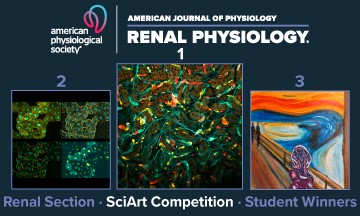 AJP Renal tweet media