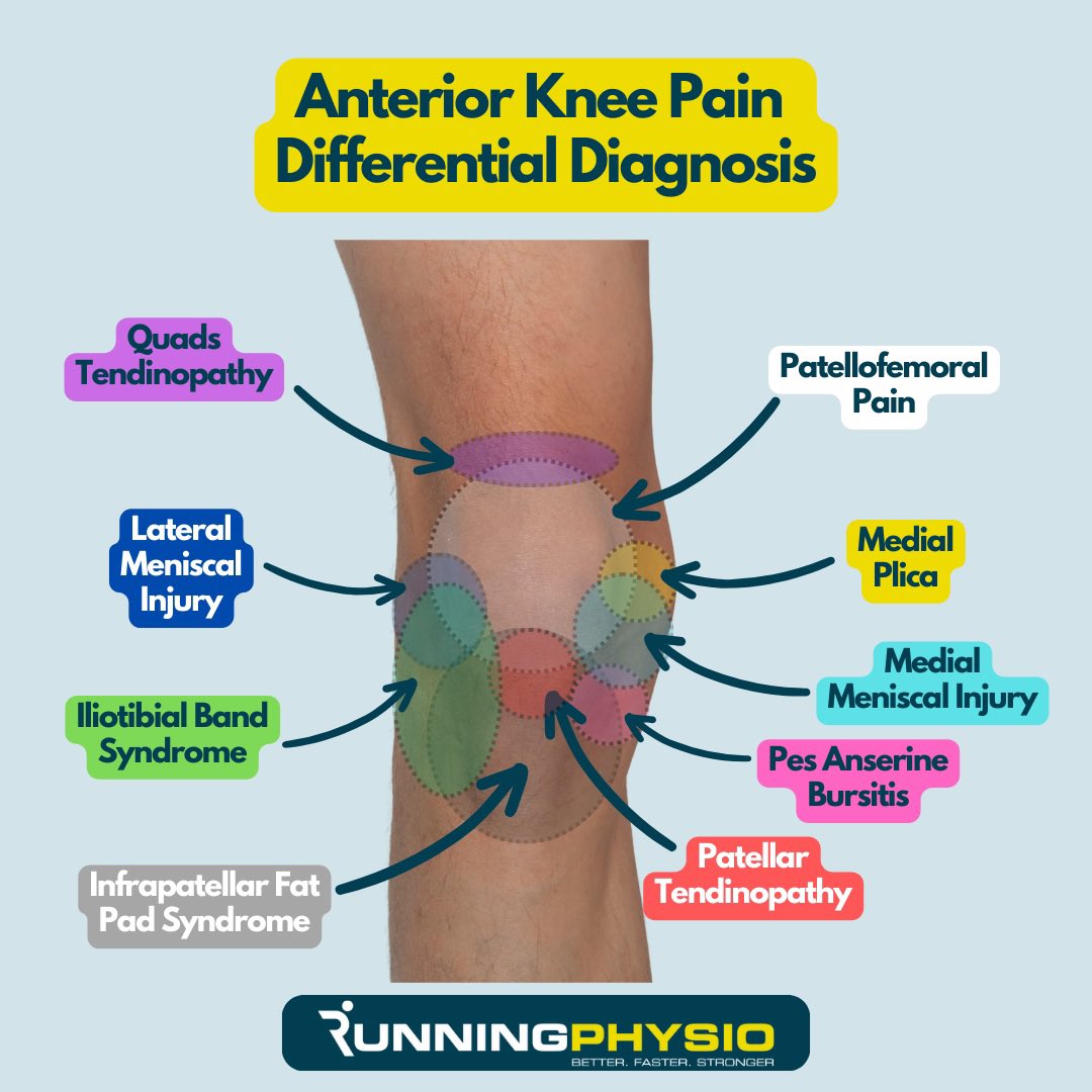 I’ve been working on a graphic for differential diagnosis in anterior knee pain… have I forgotten anything?! In truth I’m not sure I can fit much more on! 😂