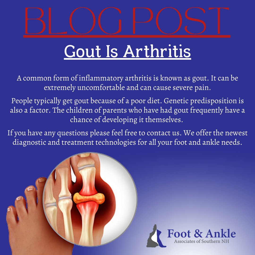 Read more: footandanklesnh.com/blogs/item/34-…
.
.
.
#gout #arthritis #blog #medicalblog #podiatryblog #follow #podiatry #podiatrylife #podiatrist #footandanklespecialist #NewHampshire #podiatrists #podiatrypractice #bestpodiatrists #FootAndAnkleAssociatesOfSouthernNewHampshire #FAASNH