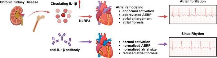 Inflammasome pathway activation promotes atrial fibrillation in chronic kidney disease: buff.ly/3RIz6hG @naliphd @XWehrens @bcmhouston #Cardiology