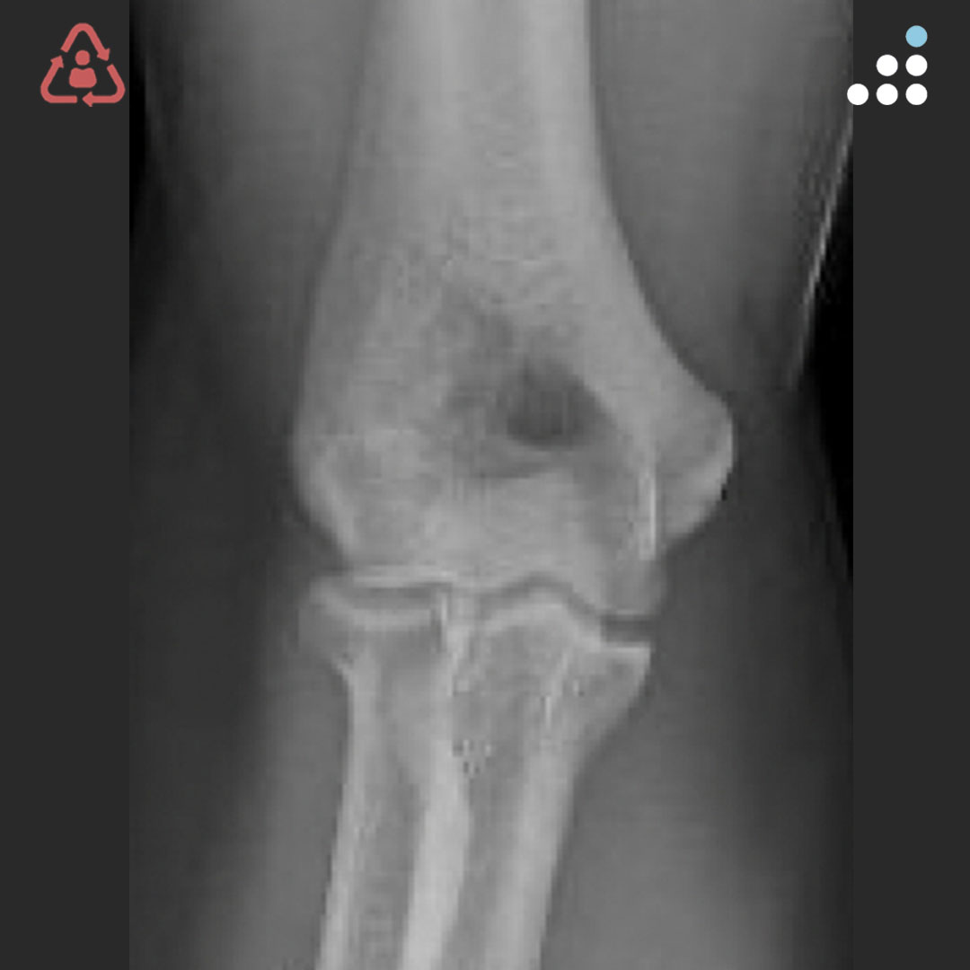 Orthobullets tweet media