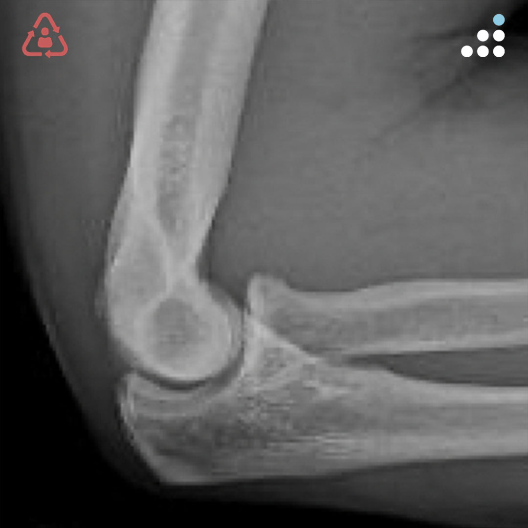 Orthobullets tweet media