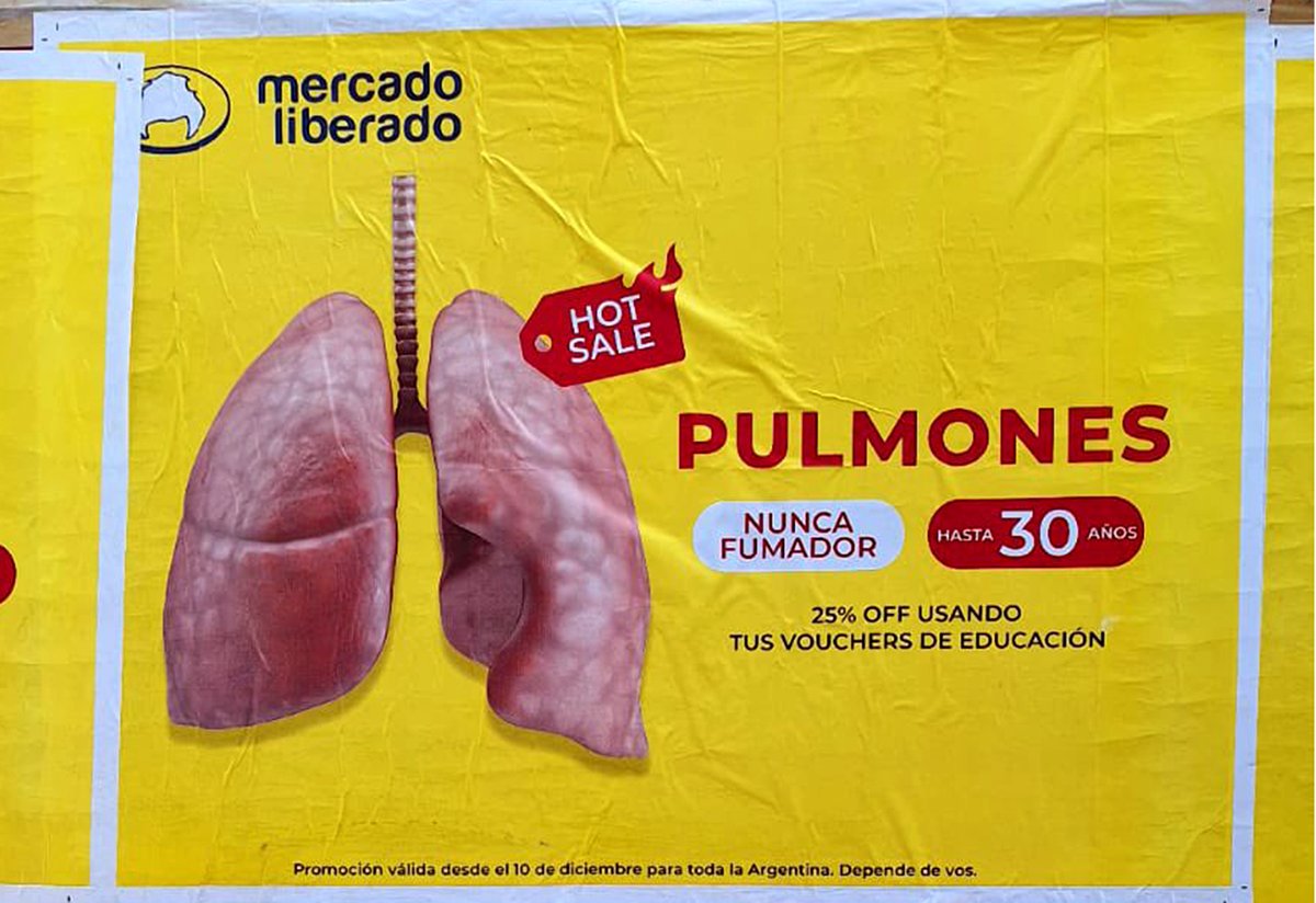 UxpSalud's tweet photo. Tus órganos no son moneda de cambio. https://t.co/ZSmVXfdaf8