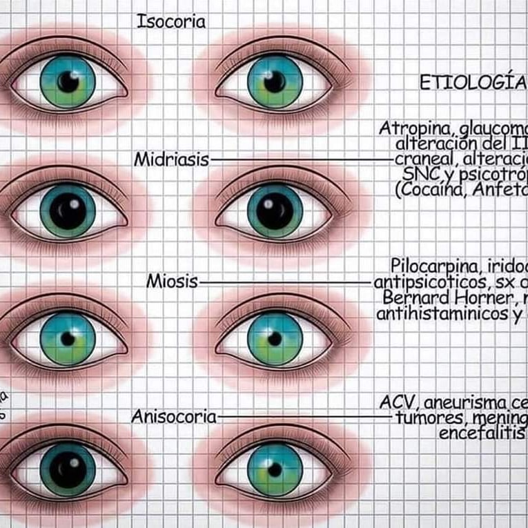 NiltonVi's tweet photo. VALORACIÓN DE PUPILAS 

#MEDICINA 
#ENFERMERÍA https://t.co/qosHhGjyJk