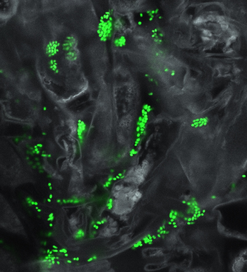Open PhD position <a href="/UniOulu/">University of Oulu</a>. We’re studying the lifestyle of the methane-consuming bacteria living inside pine trees (molecular microbiology, microscopy, metagenomics). 🦠🌲🧪🔬🧬DL 15.10.2023! Please apply or spread the word! oulunyliopisto.varbi.com/en/what:job/jo…