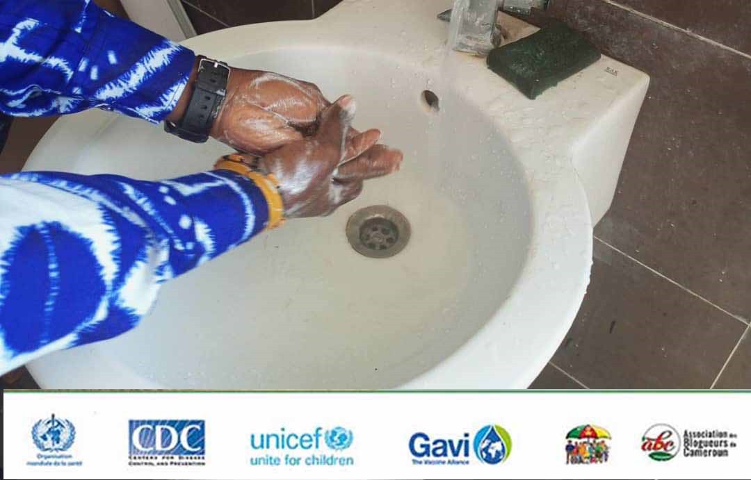 KamdemKlove's tweet photo. Le lavage des mains est une méthode preventive contre le choléra, Covid-19, Mpox... Tu as lavé t'es mains combien de fois aujourd'hui ?
#ABCforHealth #ABCJ23 @ccouspcameroun @NGATCHOU https://t.co/A6PJsH810y