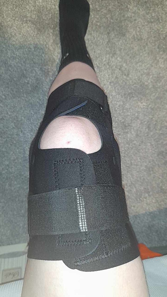 PaigeFowler_22's tweet photo. Looks like I'm not going to be playing football for a while. As I've kicked the ball the opposition came in hit my knee and I've dislocated my kneecap. Gotta have an MRI to see if I have chipped my bone and I've got fluid on my knee so badly swollen 😫 https://t.co/t346HWzUAU