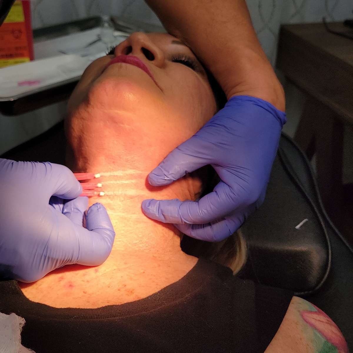 CollageneA's tweet image. Elevate sagging skin, reduce jowls, and unveil a smoother, more refined appearance with our smooth thread treatments. Book an appointment today!

#SmoothThreads bit.ly/3D7BFyY