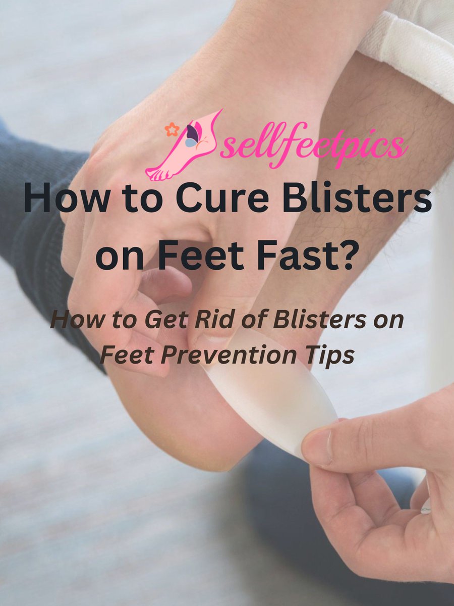 How to Cure Blisters on Feet Fast?😘
sellfeetpics.co/how-to-cure-bl…
#feetcare #feetbeauty #feet #feetpics