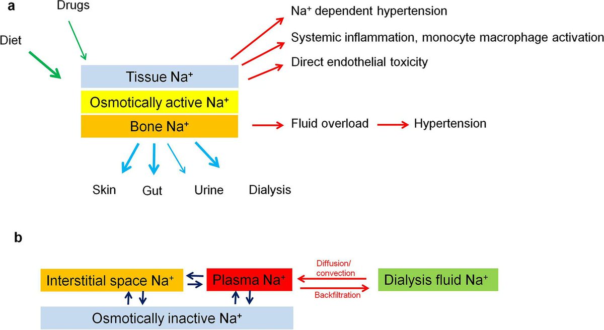 The risk of cardiovascular disease remains exceedingly high in pediatric patients w/CKD stage 5 on dialysis. Read this Review of intradialytic Na+ handling & strategies to optimize dialytic Na+ removal in pediatric patients on HD & PD. link.springer.com/article/10.100…