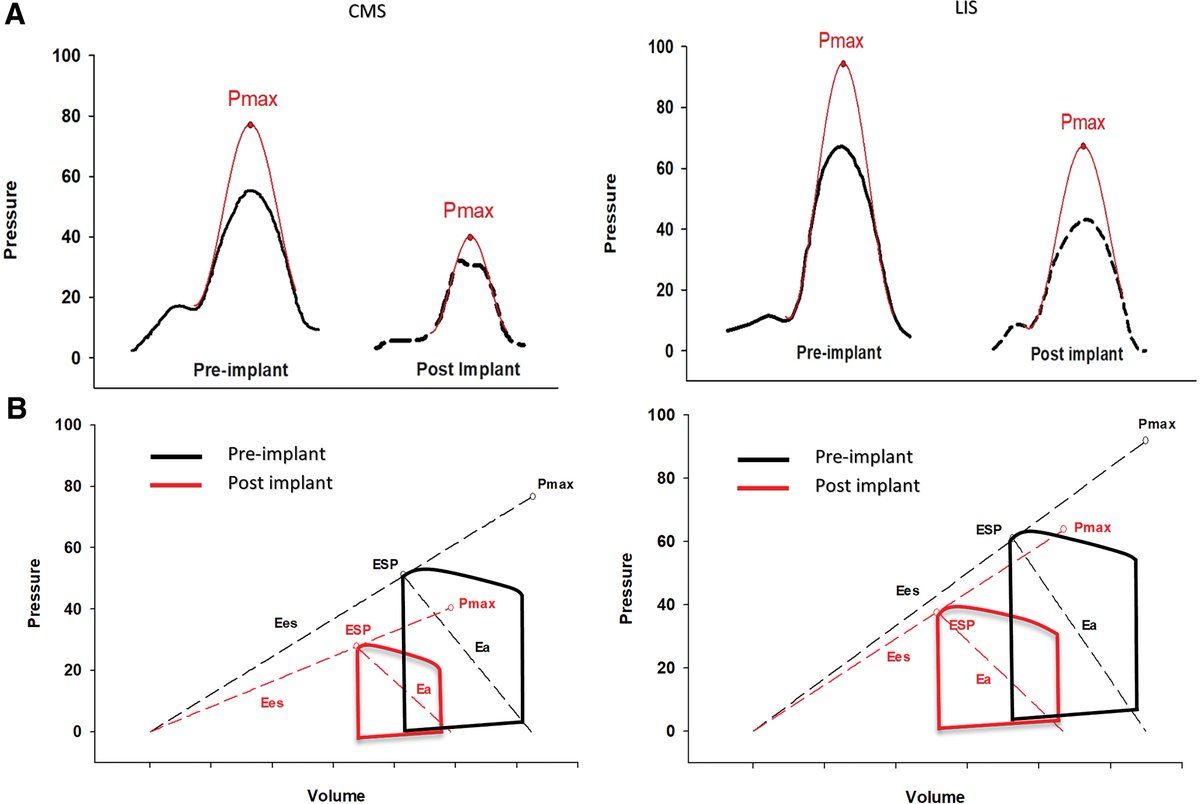 We retrospectively analyzed & digitized RV pressure tracings from 42 CMS and 21 LIS pts before and after LVAD implant. Using single beat methodology, & automated software from the great @RRVdpool, we derived load-independent RV contractility (Ees), Ea and RV-PA couling (Ees/Ea)