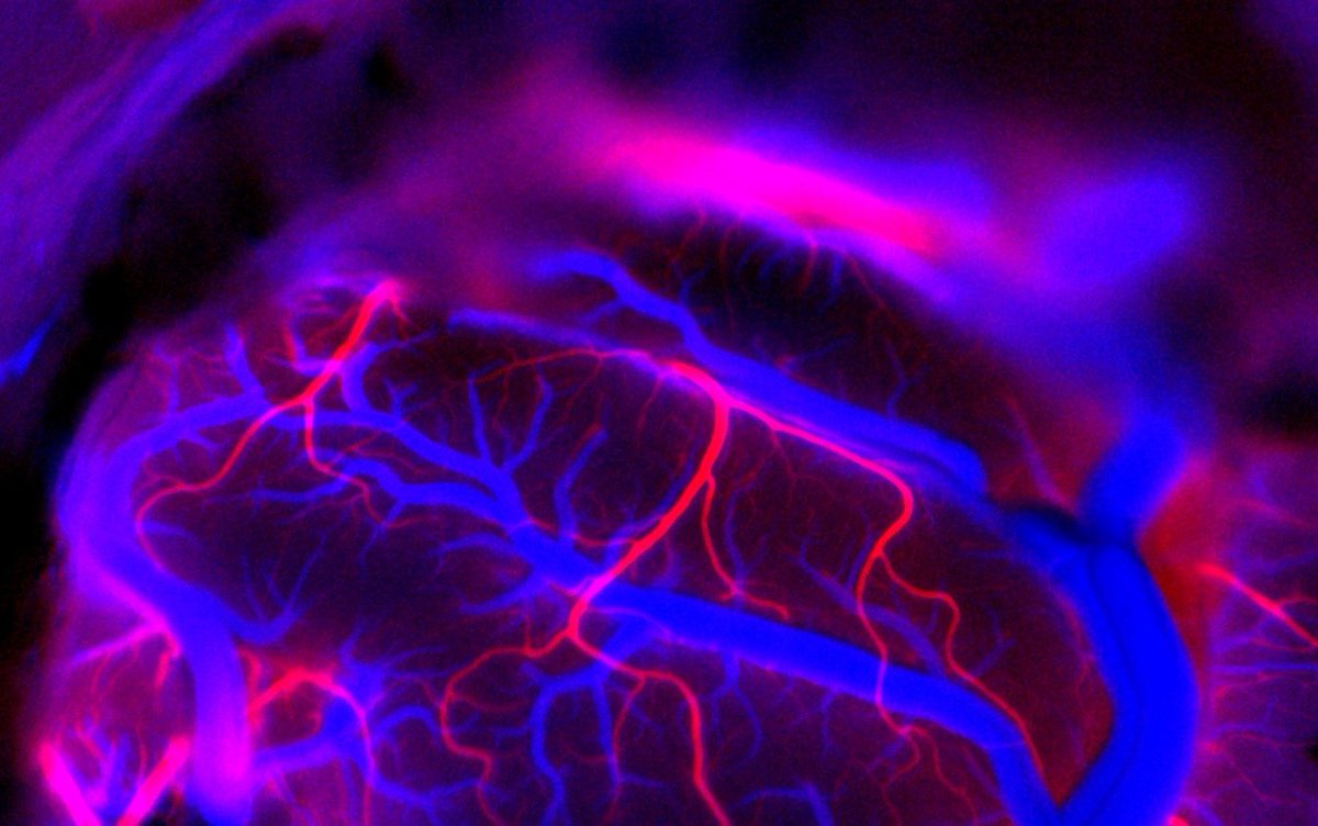 neuralink's tweet image. The surface of the brain is highly vascularized, and avoiding blood vessels when implanting electrodes is no small feat! Fluorescent dye imaging can allow our robot to resolve smaller vessels and distinguish between arteries (red) and veins (blue) in this false color image 🔴🔵