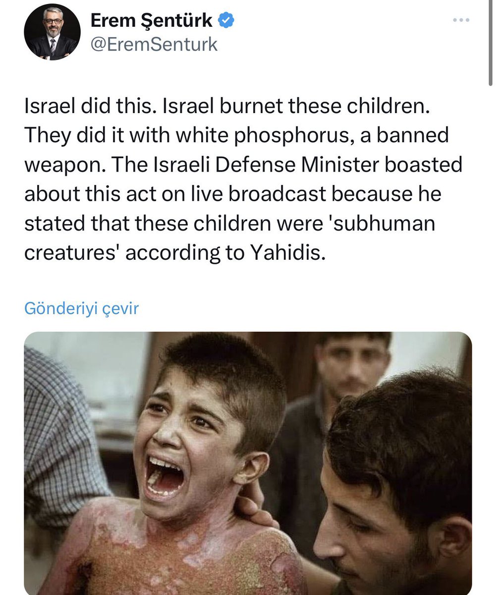 İsrail insanlık suçu işliyor diye paylaştığı fotoğraftaki çocuk Kürt olduğu anlaşılınca hemen twiti silip kafayı kuma gömüyor.Yani diyorki Kürt’se bu hale sokulabilir,Siyasal İslamcılık tek kelime ile budur.