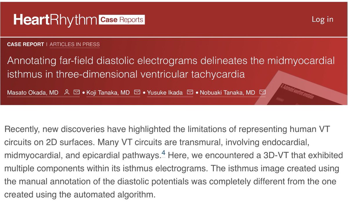 Shaojie Chen (@shaojiechen1) on Twitter photo again, 3D delineation/understanding VT,
then #ablateVT
“Manuel” Annotating far-field diastolic electrograms delineates midmyocardial isthmus in 3-dimensional ventricular tachycardia
Okada & colleagues <a href="/HRS_CaseReports/">Heart Rhythm Case Reports</a>
<a href="/TJaredBunch/">Thomas Jared Bunch</a> <a href="/dredcronin/">Edmond Cronin</a> @d_changy <a href="/ftrae/">Piotr Futyma, MD</a> <a href="/CRB_EP/">Chirag Barbhaiya</a> again, 3D delineation/understanding VT,
then #ablateVT
“Manuel” Annotating far-field diastolic electrograms delineates midmyocardial isthmus in 3-dimensional ventricular tachycardia
Okada & colleagues <a href="/HRS_CaseReports/">Heart Rhythm Case Reports</a>
<a href="/TJaredBunch/">Thomas Jared Bunch</a> <a href="/dredcronin/">Edmond Cronin</a> @d_changy <a href="/ftrae/">Piotr Futyma, MD</a> <a href="/CRB_EP/">Chirag Barbhaiya</a>