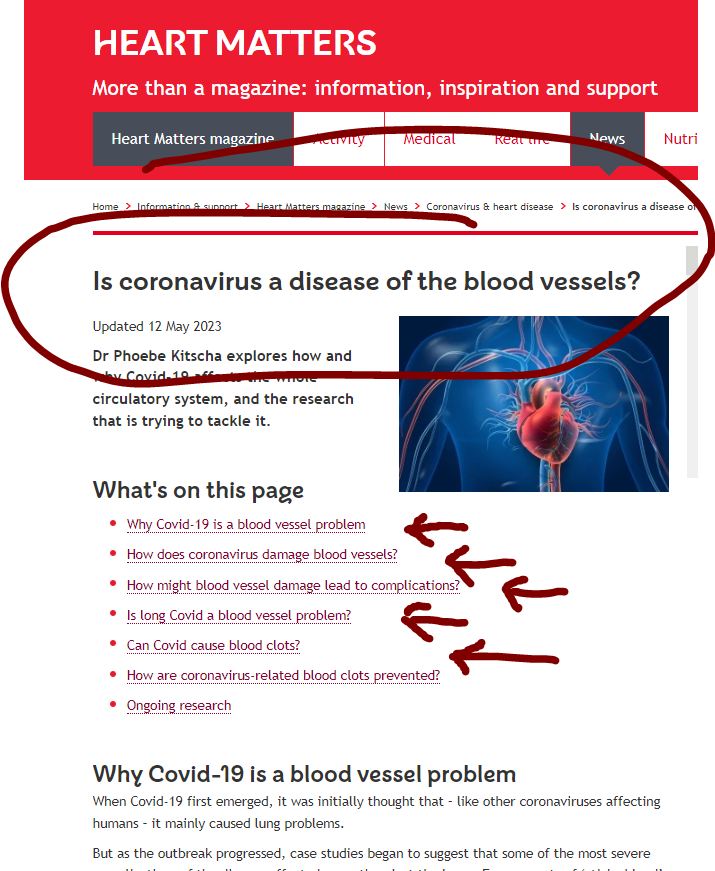 1goodtern's tweet photo. Is Covid a disease of the blood vessels?
🔥Yes🔥
🚨Yes, it is🚨
Here from the people who know, 
🫀The British Heart Foundation🫀
⏬⏬⏬⏬⏬⏬⏬⏬⏬