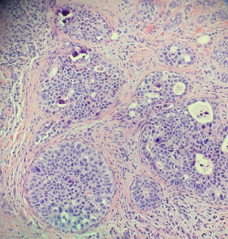 Holly J. Mitzel, MD tweet media