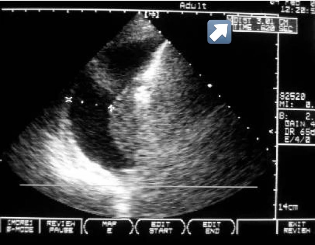 CardioMotorizado tweet media